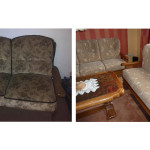 Aufpolsterung_vornachher_4